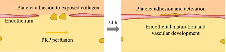 Transforming Endothelium with Platelet‐Rich Plasma in Engineered Microvessels